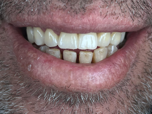 Smile 2