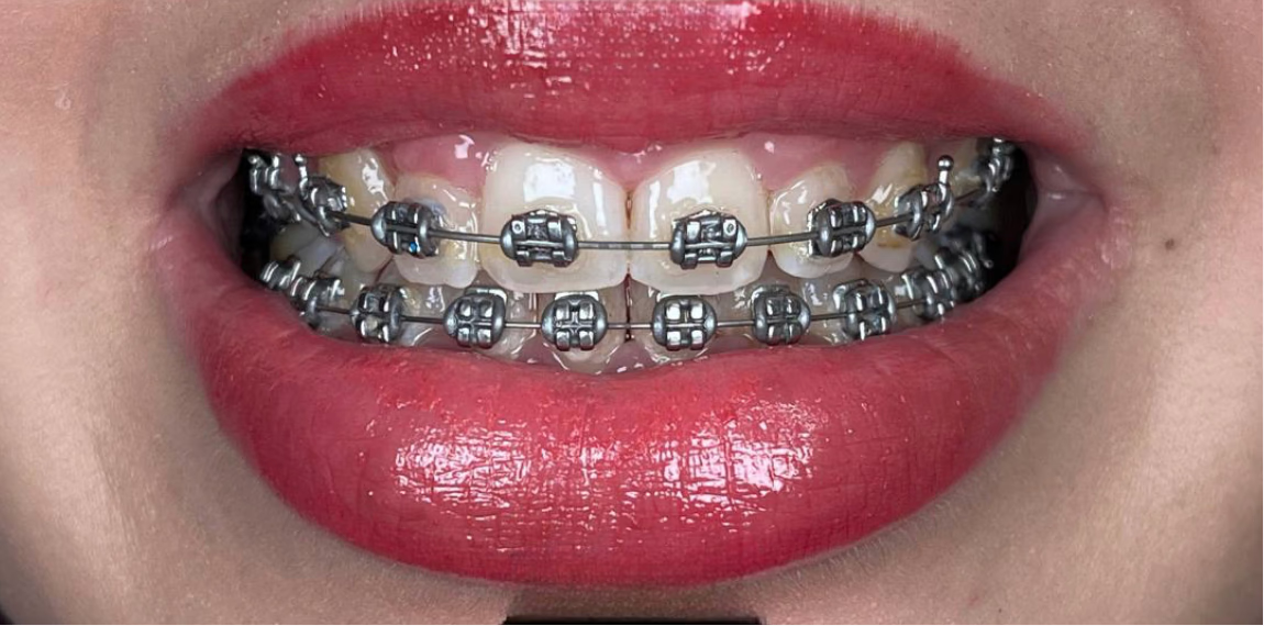 Smile 3
